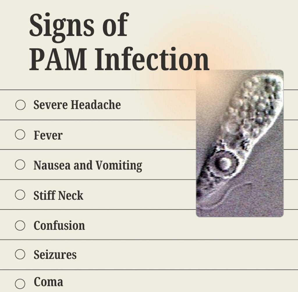 A graph outlining the signs of PAM infection caused by brain-eating amoeba.